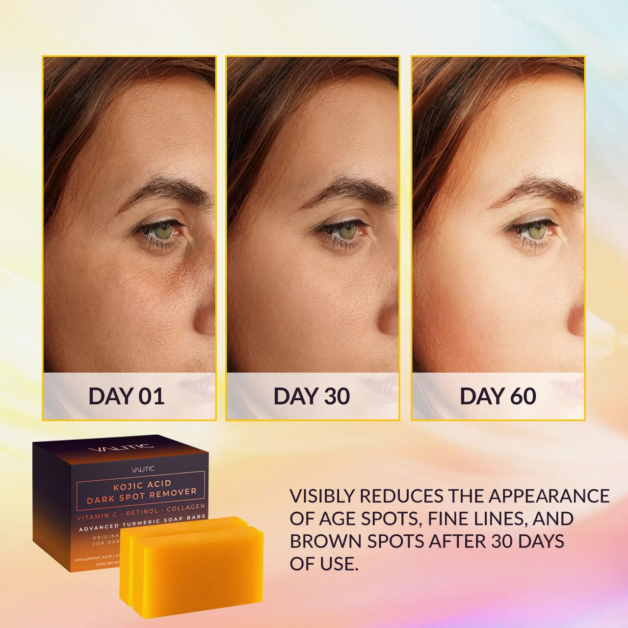 Valitic Kojic Acid Dark Spot Remover Soap Bar with Vitamin C, Retinol, Collagen, Turmeric - Original Japanese Complex - Hyaluronic Acid, Vitamin E, Shea Butter, Castile Oil ( 4 Pack ) With Soap Holder