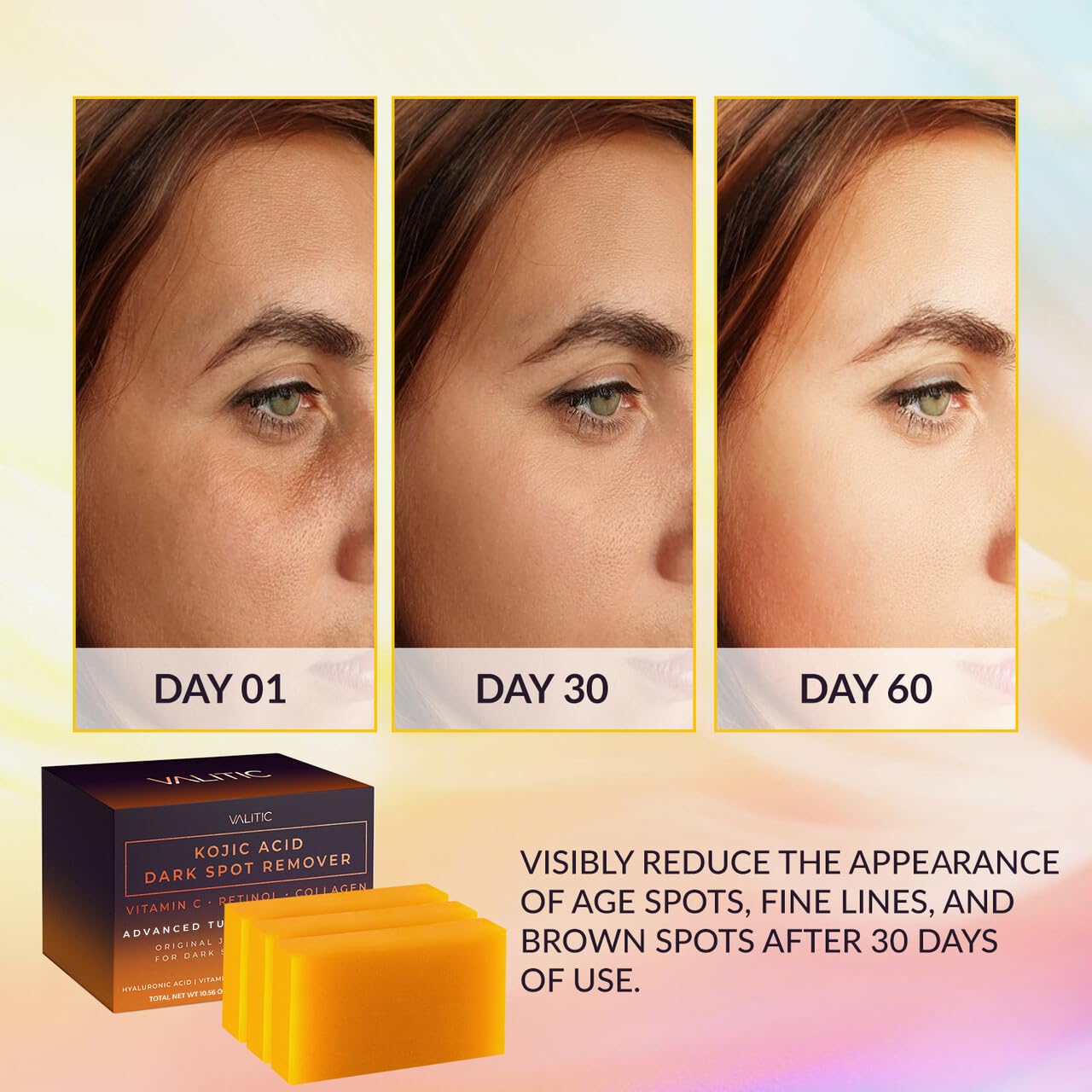 Valitic Kojic Acid Dark Spot Remover Soap Bar with Vitamin C, Retinol, Collagen, Turmeric - Original Japanese Complex - Hyaluronic Acid, Vitamin E, Shea Butter, Castile Oil ( 4 Pack ) With Soap Holder
